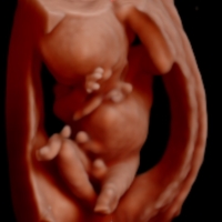 Pretecho Praktijk Prenatale Echografie Rosmalen